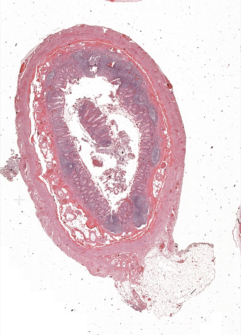 H&E of a human appendix section